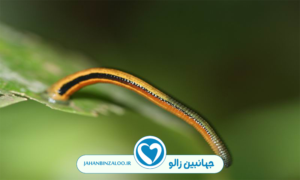 عوارض زالو درمانی و نکات مهم آن
