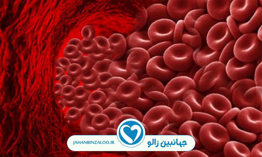 خواص زالو درمانی برای غلظت خون
