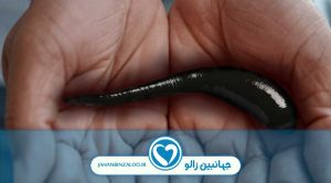 زالو