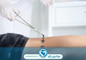 زالو