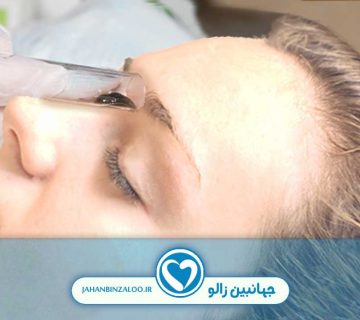 زالو