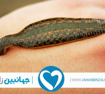 قیمت زالو