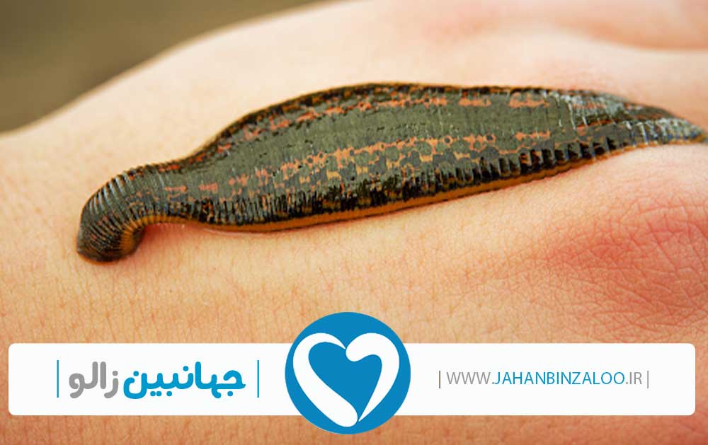 قیمت زالو