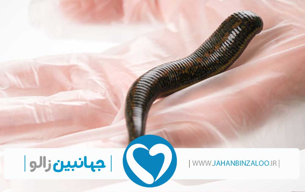قیمت زالو