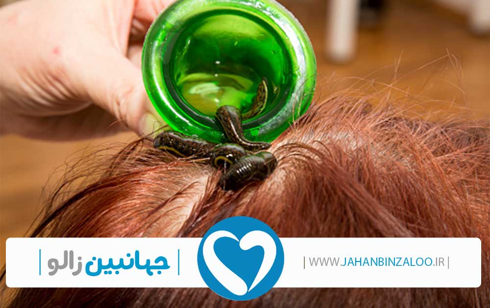قیمت زالو