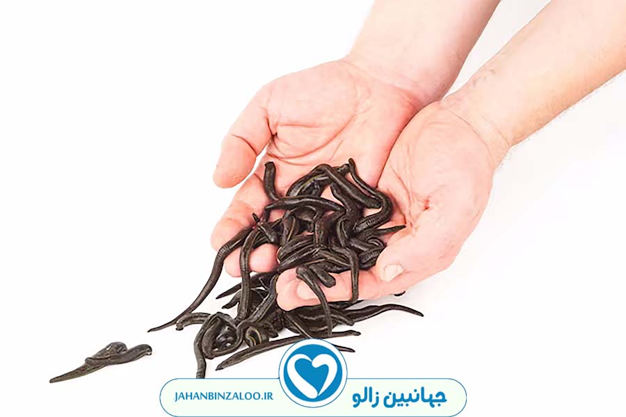 زالودرمانی|فروش زالو|خرید زالو|