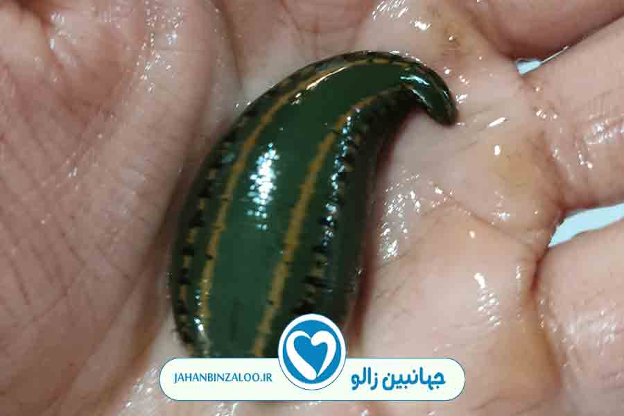 زالودرمانی|فروش زالو|خرید زالو|