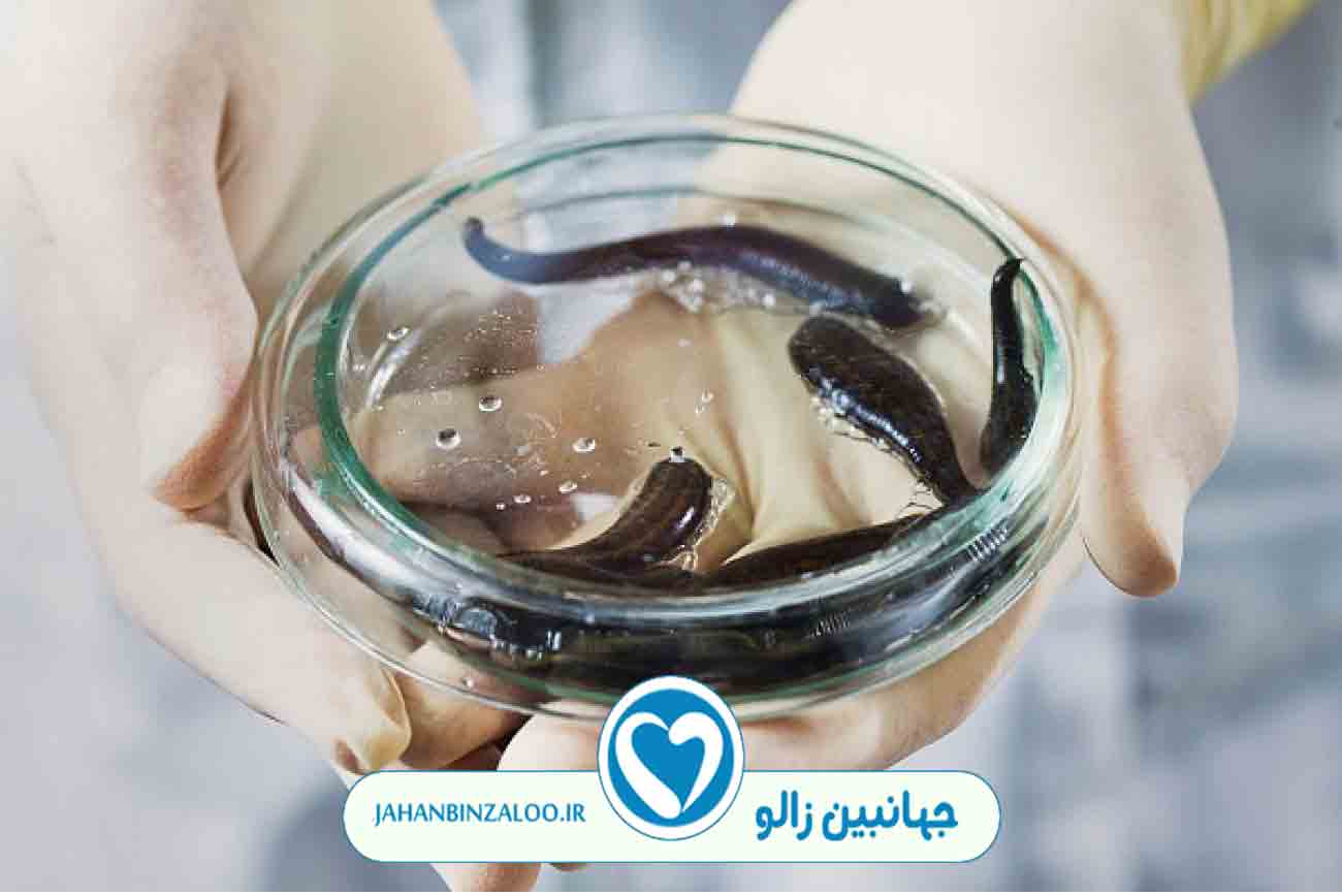 زالودرمانی|فروش زالو|خرید زالو|