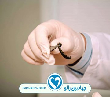 زالودرمانی|فروش زالو|خرید زالو|