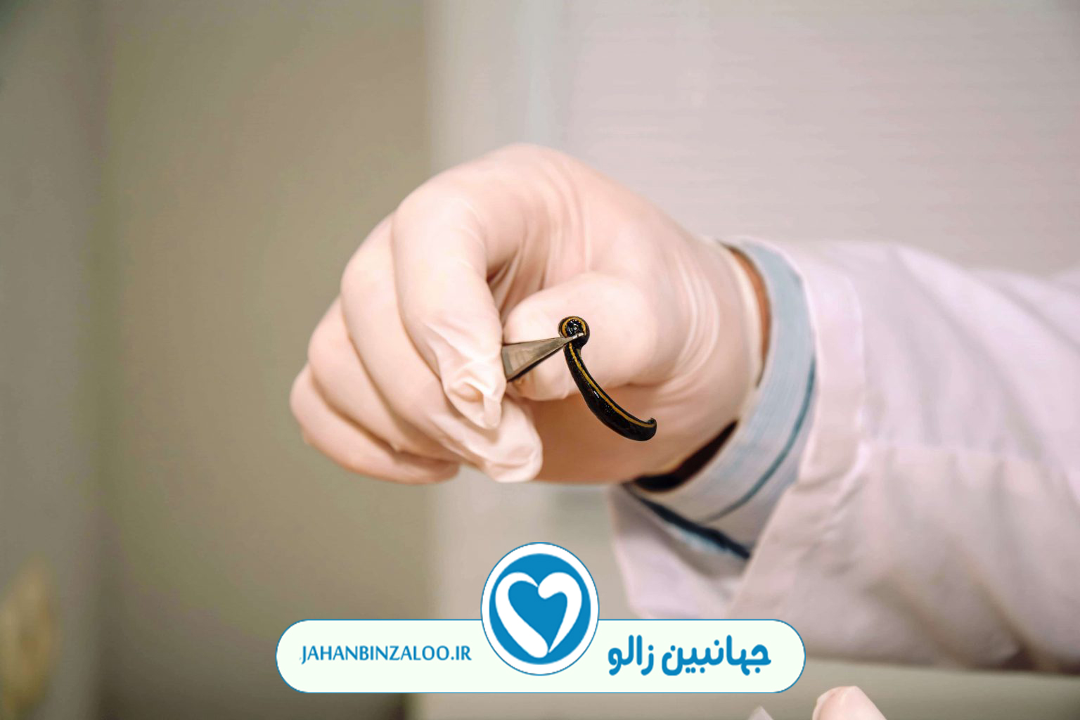 زالودرمانی|فروش زالو|خرید زالو|