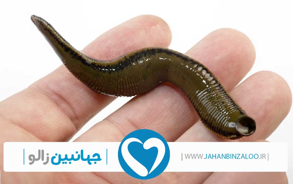 فروش زالو به صورت عمده