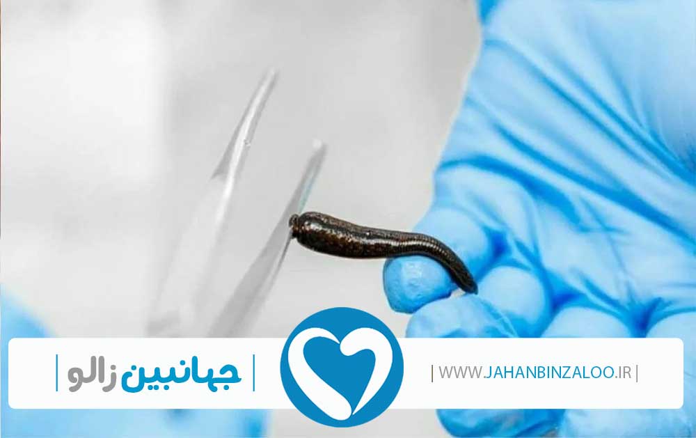 فروش زالو به صورت عمده