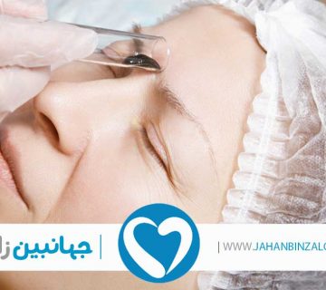 فروش زالو به صورت عمده
