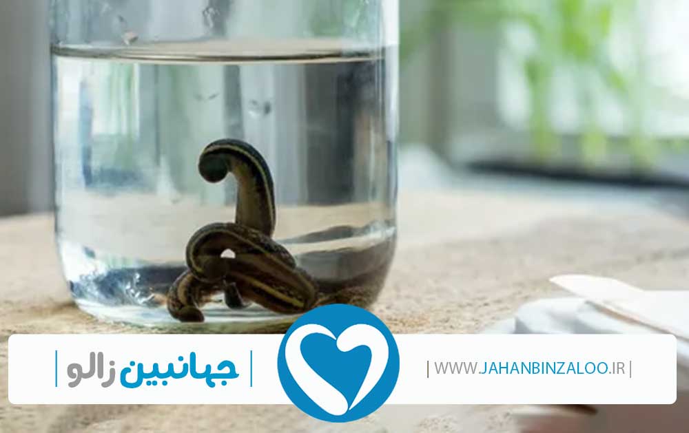 فروش زالو به صورت عمده