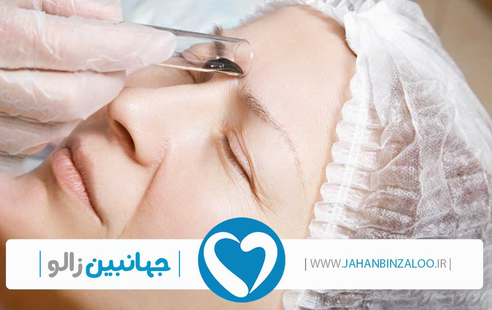 فروش زالو به صورت عمده