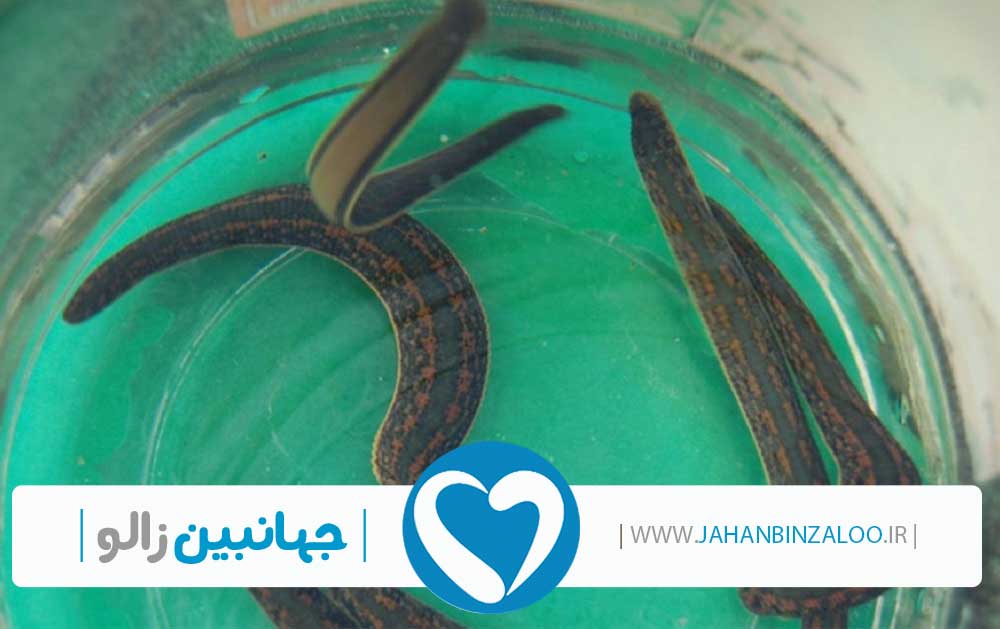 نمایندگی فروش زالو