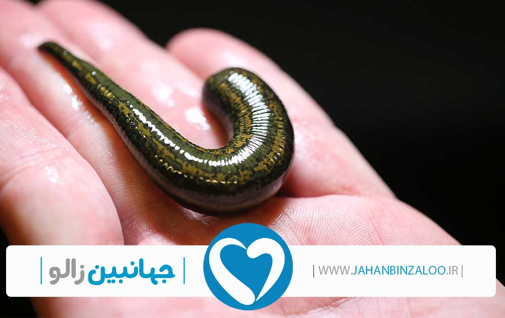 نمایندگی فروش زالو