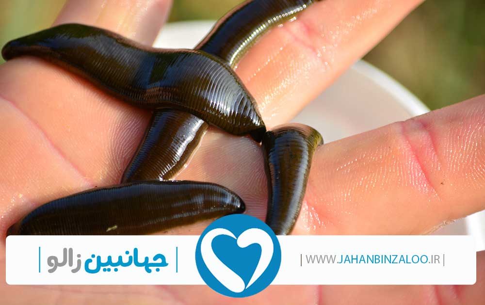 نمایندگی فروش زالو