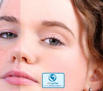 زالودرمانی|فروش زالو|خرید زالو|