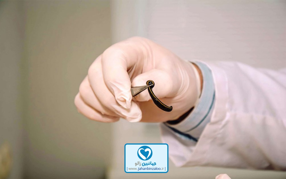 مراکز خرید زالو طبی